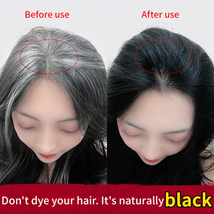 IN White Hair Turns Black Hair Shampoo Intense Repair Both Men And Women Can Skin Types All People All Right Improve Dull Hair Herbal Essence Hair Care Polygonum Multiflorum Ginger Shampoo Hair Kerati